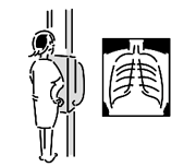 胸部エックス線の検査を受けている人のイラスト