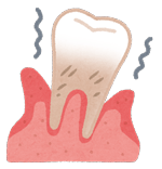歯がぐらついているイラスト